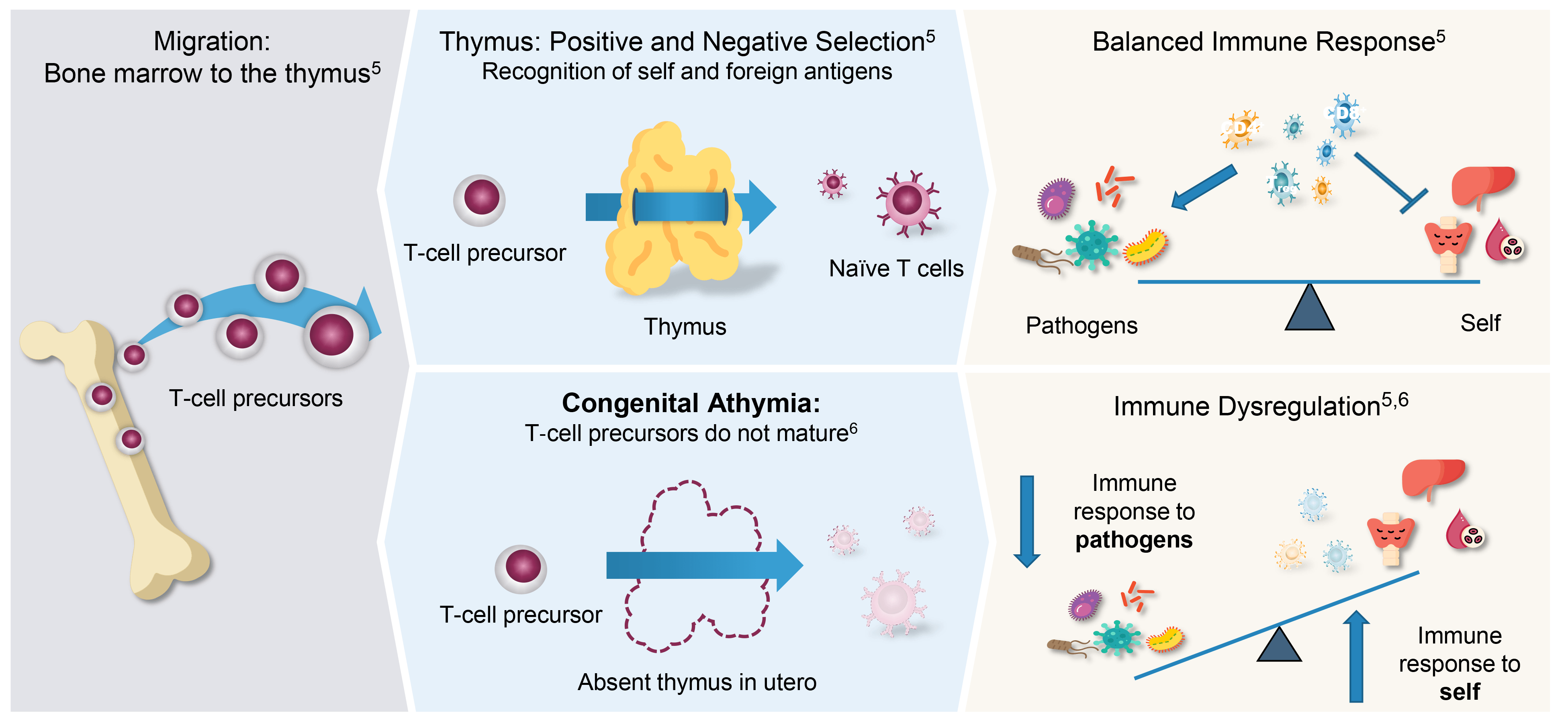A textbook illustration showing the mechanism of congenital athymia